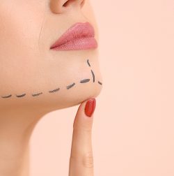 Jaw reshaping surgery in Delhi| dr. Saroj k. Sheoran