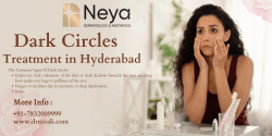 Dark Circles Treatment in Hyderabad