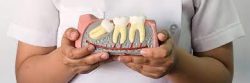 Wisdom Tooth Extraction In Delhi | dr. Saroj k. Sheoran