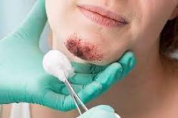 Facial trauma surgery in Delhi | dr. Saroj k. Sheoran