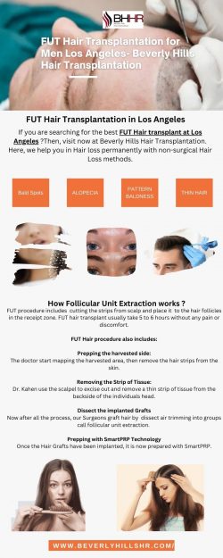 FUT Hair Transplantation Los Angeles | Beverly Hills Hair Transplantation