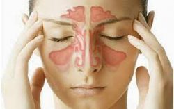 Sinus lift surgery in delhi | dr. Saroj k. Sheoran