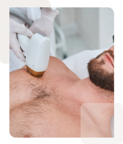 Effective Hair Removal with 808nm Diode Laser