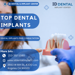 Top Dental Implants | ID Dental and Implant Center