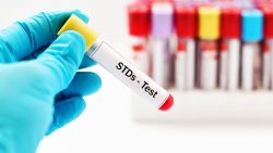 Sexually Transmitted Diseases (STDs)