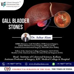 Advanced Laparoscopic Surgery for Gall bladder Stone in Kolkata