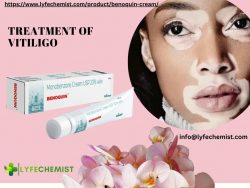 Benefits of Benoquin Cream