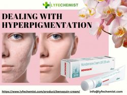 Benoquin cream use for Hyper pigmentation