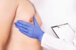 Get Rid of Gynecomastia with Expert Gynecomastia Surgery in Delhi