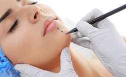 Chin Augmentation in Delhi | Dr. Rajat Gupta