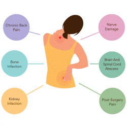 Banish Back Pain: Effective Strategies for Relief and Prevention