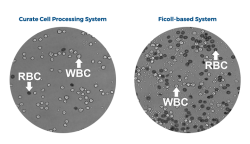 Cell Therapy Machine | Immune targeted therapy