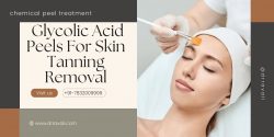 Chemical Peel Treatment for skin rejuvenation