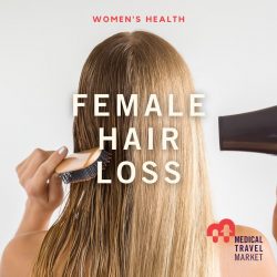 Female Hair Loss