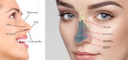 Rhinoplasty in Gurgaon | Best Rhinoplasty Surgeon in Gurgaon | RECON