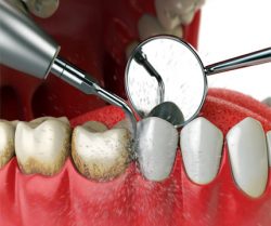 Best Dental Clinic in Vaishali Nagar