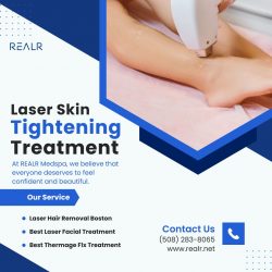 Rejuvenate and Tighten Your Skin with Laser Skin Tightening in Boston