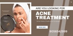 Acne Treatment in ludhiana-the Glo Medispa