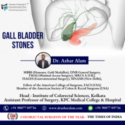 Advanced Laparoscopic Surgery for Gall bladder Stone in Kolkata