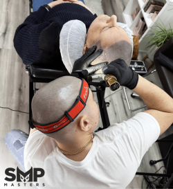 Scalp Micro Pigmentation