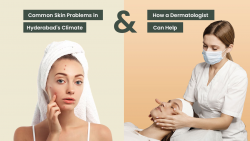 Dermatologist in Hyderabad