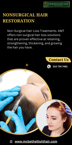 Nonsurgical Hair Restoration