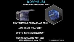 Morpheus8 Treatment: Unveiling the Secret to Ageless Beauty