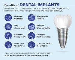 Affordable dental implants