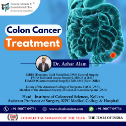 Colon Cancer Doctor