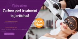 Carbon Peel Treatment in Faridabad