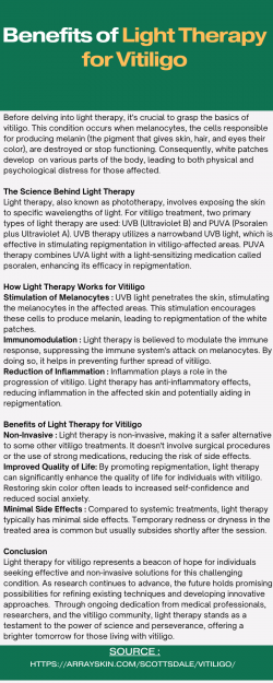 Illuminating Hope-Phototherapy for Vitiligo