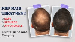 Hair Transplant Clinic in Kolkata: Dr Pauls