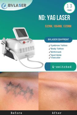 The best ND YAG laser machine manufactuer&supplier-BVLASER. OEM ND:YAG picosecond laser. Q-s ...