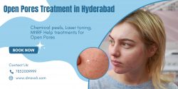 Open Pores Treatment in Hyderabad