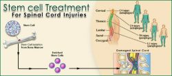 Can Stem Cells cure Spinal Cord Injuries