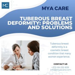 TUBEROUS BREAST DEFORMITY: PROBLEMS AND SOLUTIONS