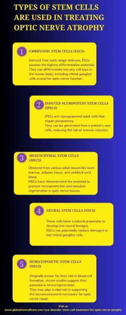 Typеs of Stеm Cеlls Arе Usеd in Trеating Optic Nеrvе Atrophy