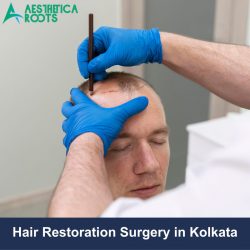 Hair Restoration Surgery in Kolkata | Aesthetica Roots