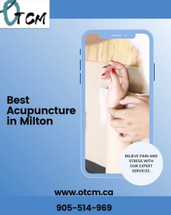 Threads of Wisdom: Exploring Best Acupuncture in Milton