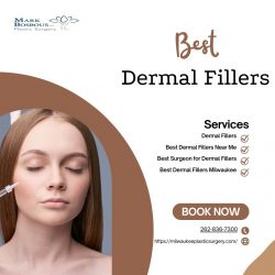 Best Dermal Fillers