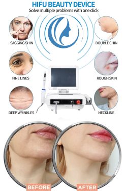 The best HIFU machine professional-BVLASER. OEM anti-aging HIFU machine. Portable HIFU machine h ...