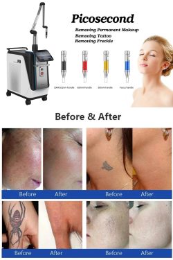 OEM picosecond laser machine-BVLASER. CE certification picosecond laser tattoo removal machine.  ...