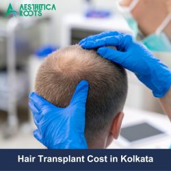 Hair Transplant Cost in Kolkata | Aesthetica Roots