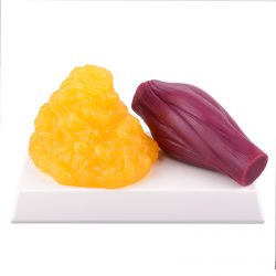 Ultrassist 1lb Fat vs 1lb Muscle Replica, Yamagata