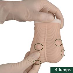 Ultrassist Testicular Self Examination(TSE) Model, Beige