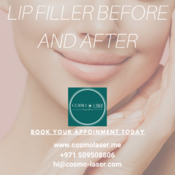 Looking for Lip Enhancement Near Me?