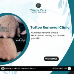 Transform Your Skin at Our Tattoo Removal Clinic