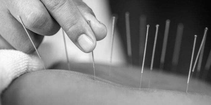 Find a Trusted Doctor of Traditional Chinese Medicine in Bayside Melbourne