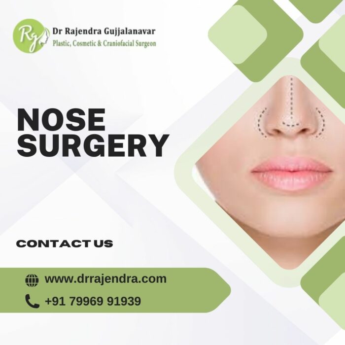 Best Rhinoplasty Surgeon in Bangalore | Nose Reshaping Surgery