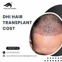 DHT Hair Transplant Bangalore | DHI Hair Transplant Cost